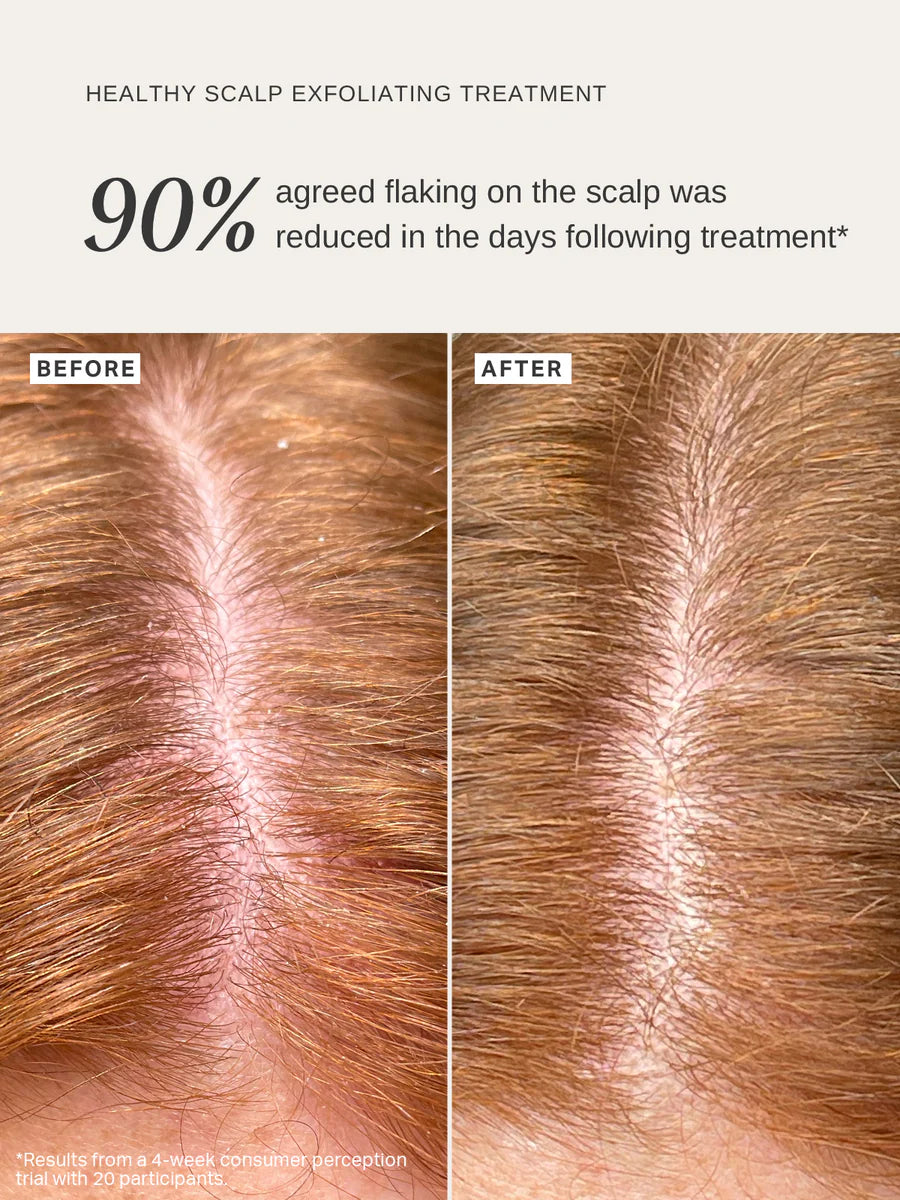 Healthy Scalp Exfoliating Treatment 100 ml