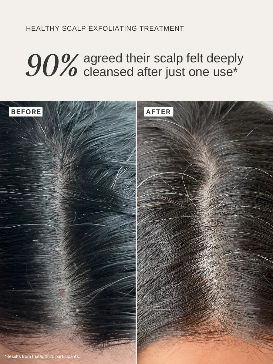 Healthy Scalp Exfoliating Treatment 100 ml