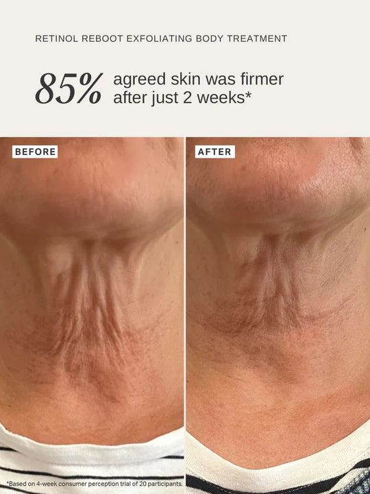 Retinol Reboot Exfoliating Body Treatment 120 ml