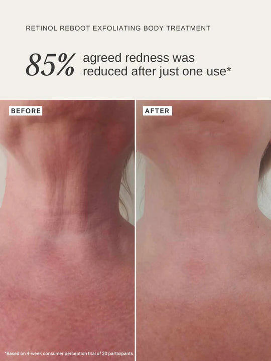 Retinol Reboot Exfoliating Body Treatment 120 ml