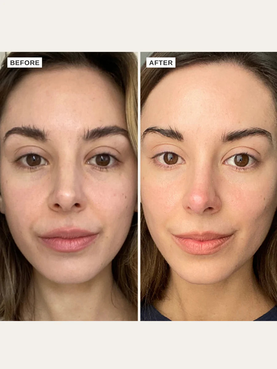 Vitamin C Serum 25 ml