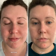 Vitamin A Serum  25 ml